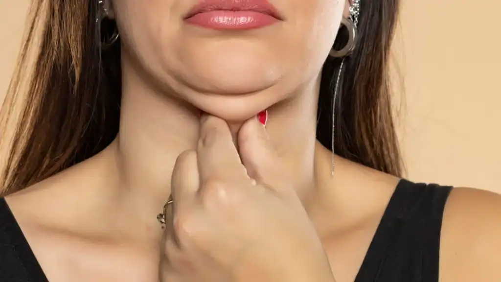 An image of a woman with double chin, sad, worried : Non Surgical Double Chin Removal Treatment in Staines, UK