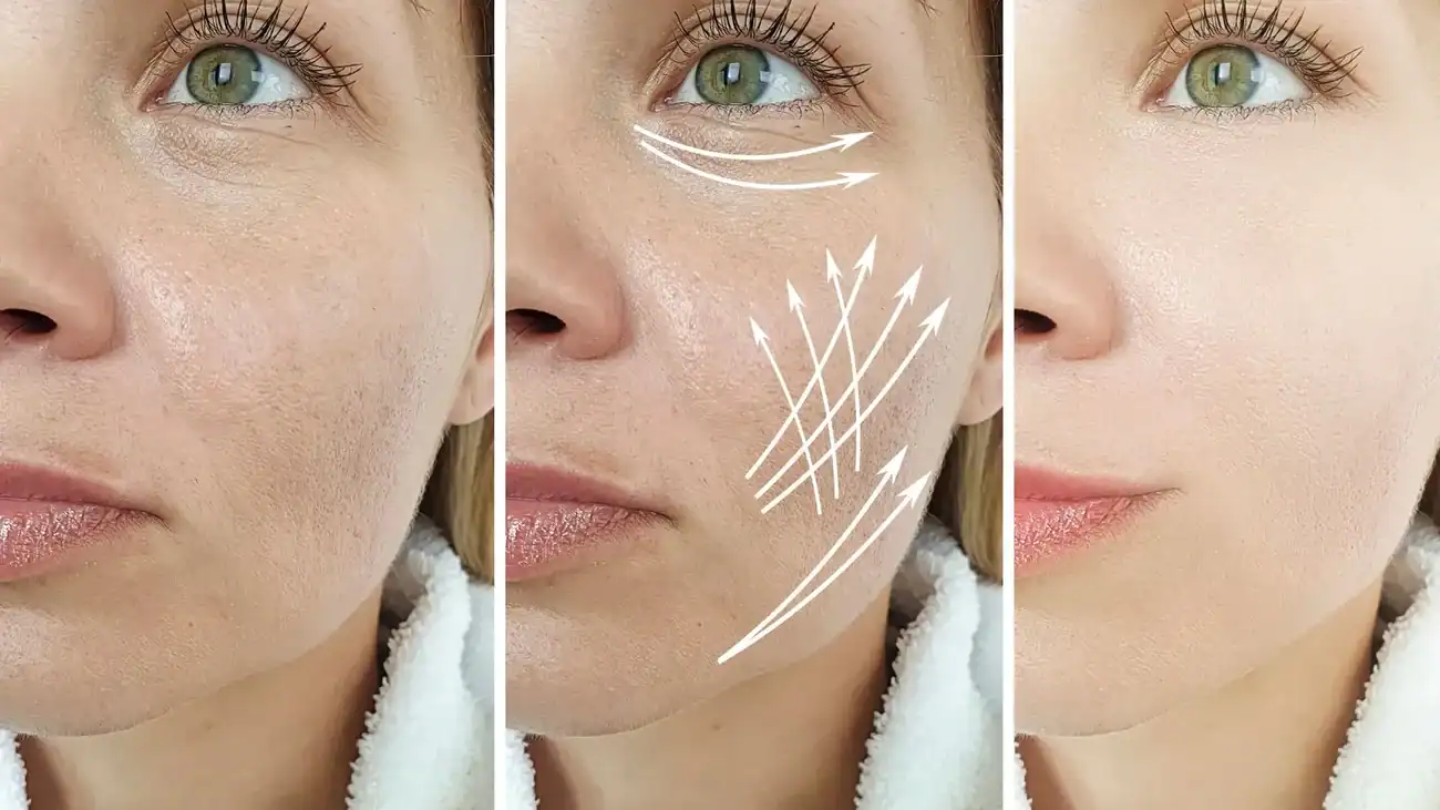 Can One Treatment Really Tackle More Than One Skin Concern Staines?