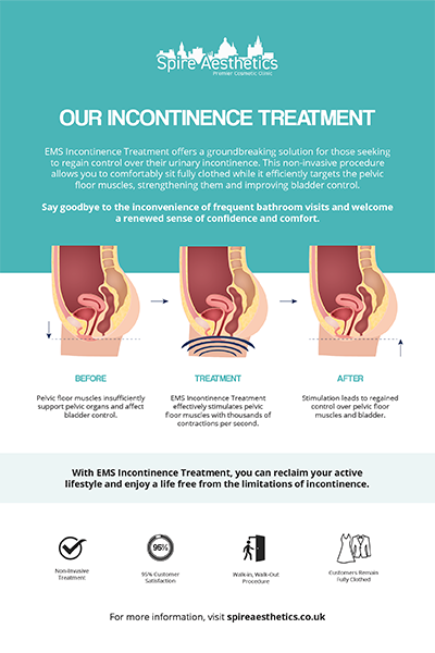 image to show how EMS treatment works for female urinary incontinence Staines