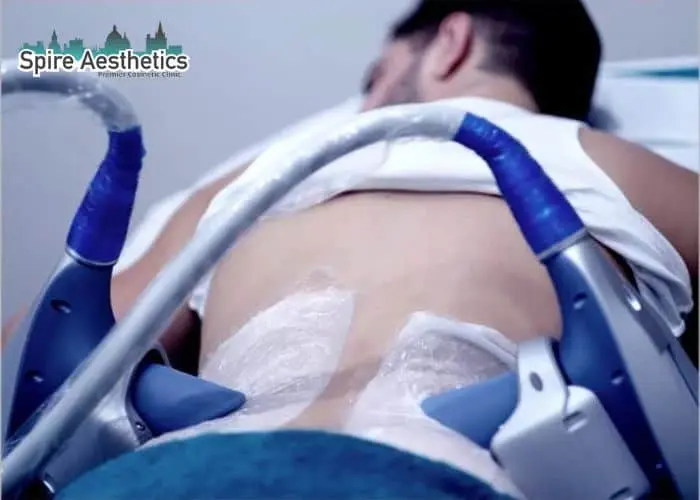 Man having fat freezing treatment done on love handles before a competitions Staines to create a sculpted look.
