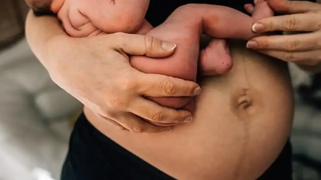 Why Is My Stomach Still Big After Pregnancy Staines?